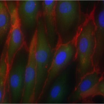 IPSC Derived Endothelial Colony Forming Cells Axol Bioscience